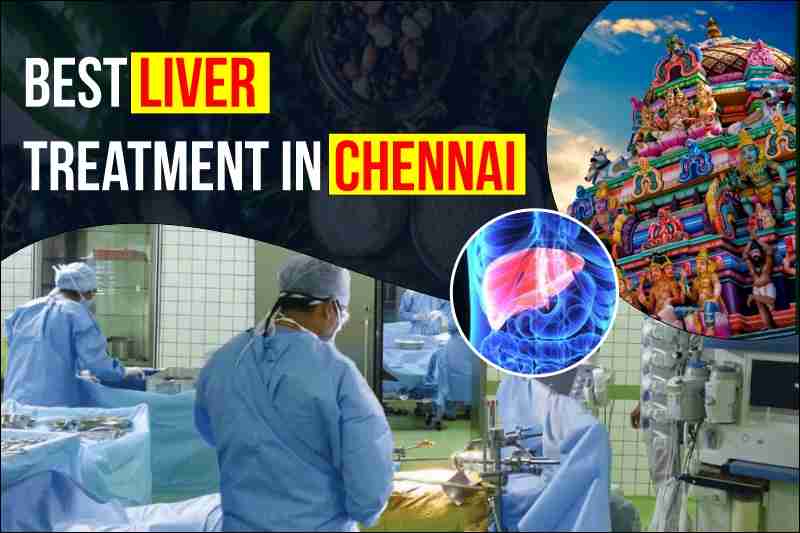 Best Liver Treatment in Chennai